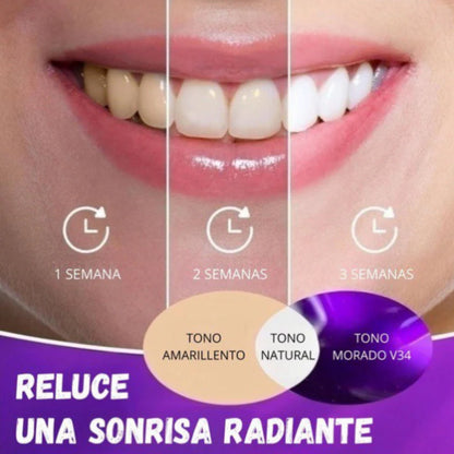 Blanqueador Dental - SmileKit